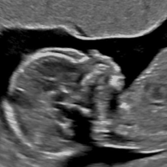 Babylist Registry Photo.