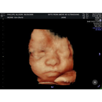 Babylist Registry Photo.