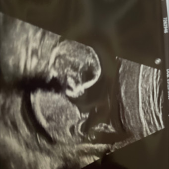 Babylist Registry Photo.