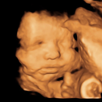 Shauntae's Baby Registry Photo.
