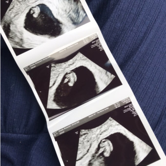 Babylist Registry Photo.