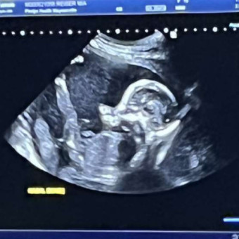 Babylist Registry Photo.