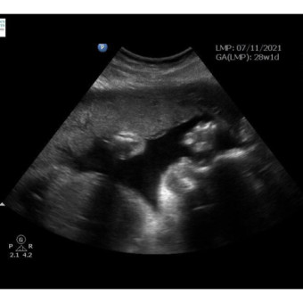 Babylist Registry Photo.