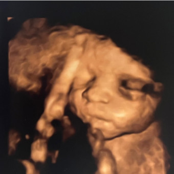 Babylist Registry Photo.