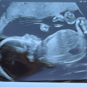Babylist Registry Photo.