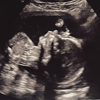 Babylist Registry Photo.