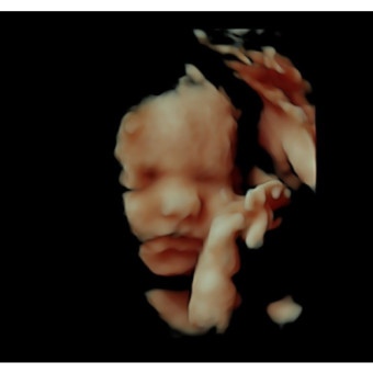 Babylist Registry Photo.