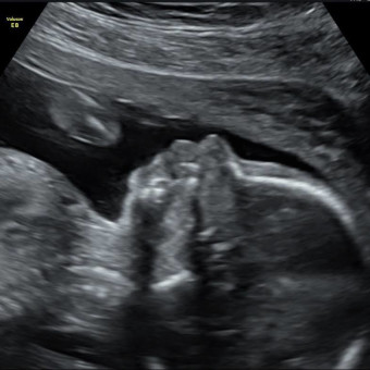 Babylist Registry Photo.