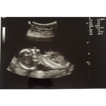 Babylist Registry Photo.