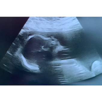 Babylist Registry Photo.