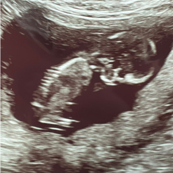 Babylist Registry Photo.