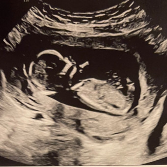Babylist Registry Photo.