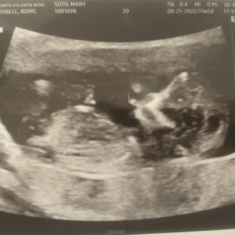 Babylist Registry Photo.