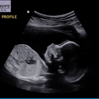 Babylist Registry Photo.
