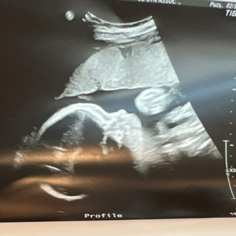 Babylist Registry Photo.