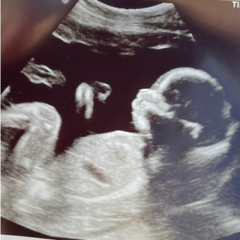 Babylist Registry Photo.