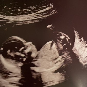 Babylist Registry Photo.