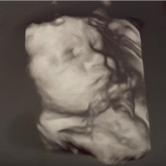 Babylist Registry Photo.