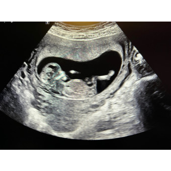 Babylist Registry Photo.