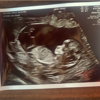 Babylist Registry Photo.