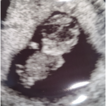 Babylist Registry Photo.