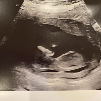 Babylist Registry Photo.