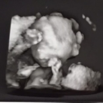 Babylist Registry Photo.