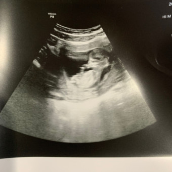 Babylist Registry Photo.