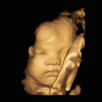 Babylist Registry Photo.