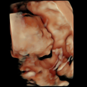 Babylist Registry Photo.