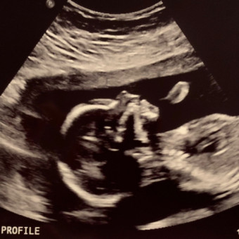 Babylist Registry Photo.