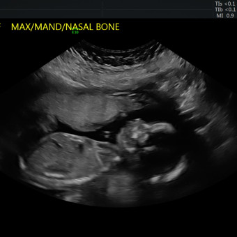 Babylist Registry Photo.