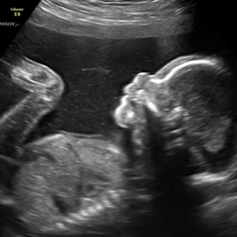 Babylist Registry Photo.