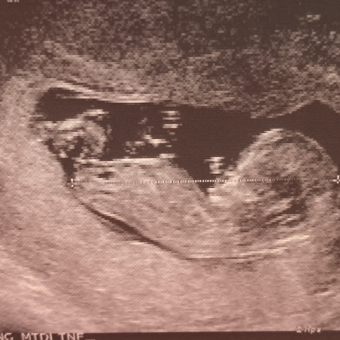 Babylist Registry Photo.