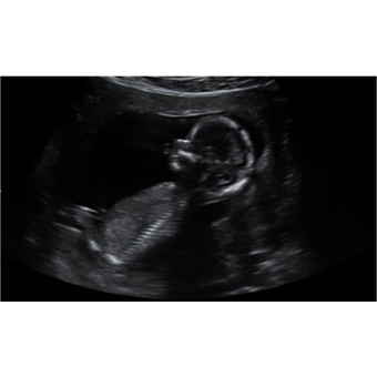 Babylist Registry Photo.