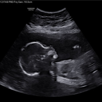 Babylist Registry Photo.