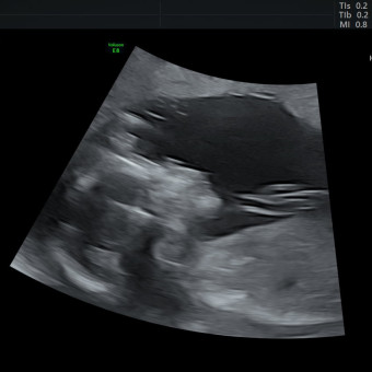 Babylist Registry Photo.