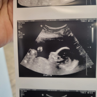 Babylist Registry Photo.