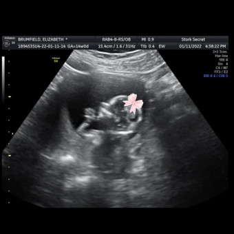Babylist Registry Photo.