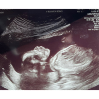 Babylist Registry Photo.