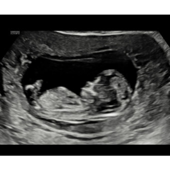 Babylist Registry Photo.