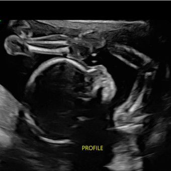 Babylist Registry Photo.