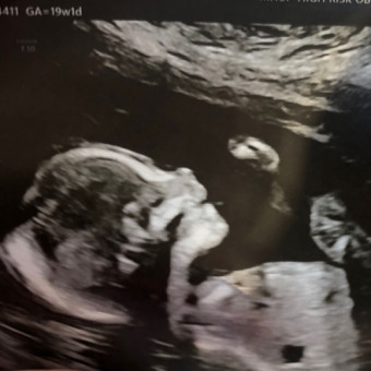 Babylist Registry Photo.