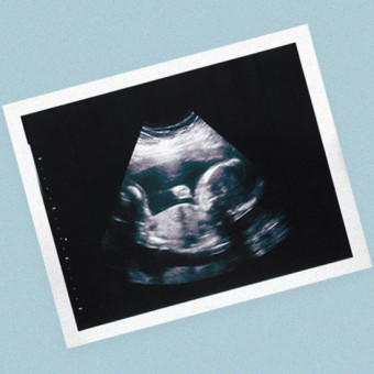 Babylist Registry Photo.