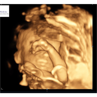 Babylist Registry Photo.