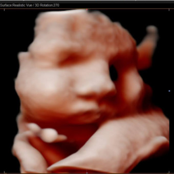 Babylist Registry Photo.