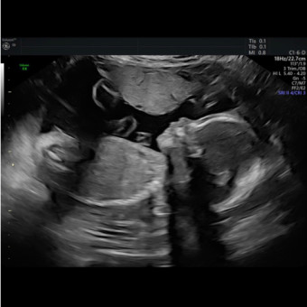 Babylist Registry Photo.