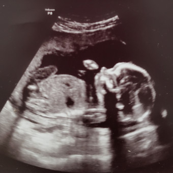 Babylist Registry Photo.