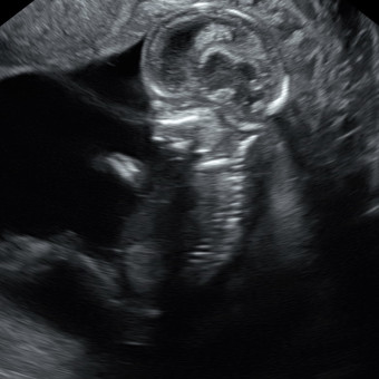 Babylist Registry Photo.