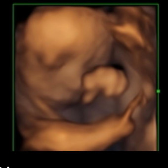 Babylist Registry Photo.